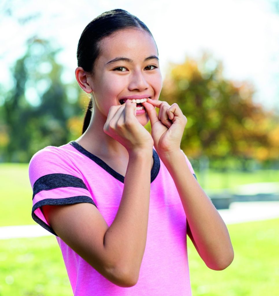 Teen with Invisalign aligner